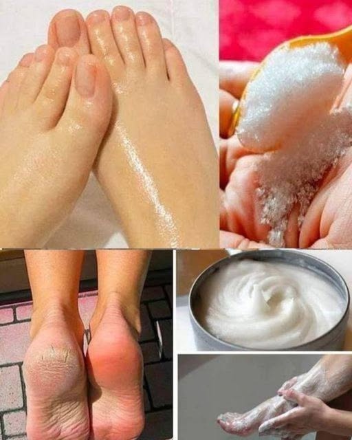 Magia Domowej Pedicure: Jak Zrobić Profesjonalną Pedicure z Sodą Oczyszczoną i Mlekiem!