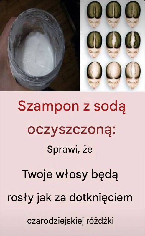 Szampon z sodą oczyszczoną: magiczne rozwiązanie na porost włosów