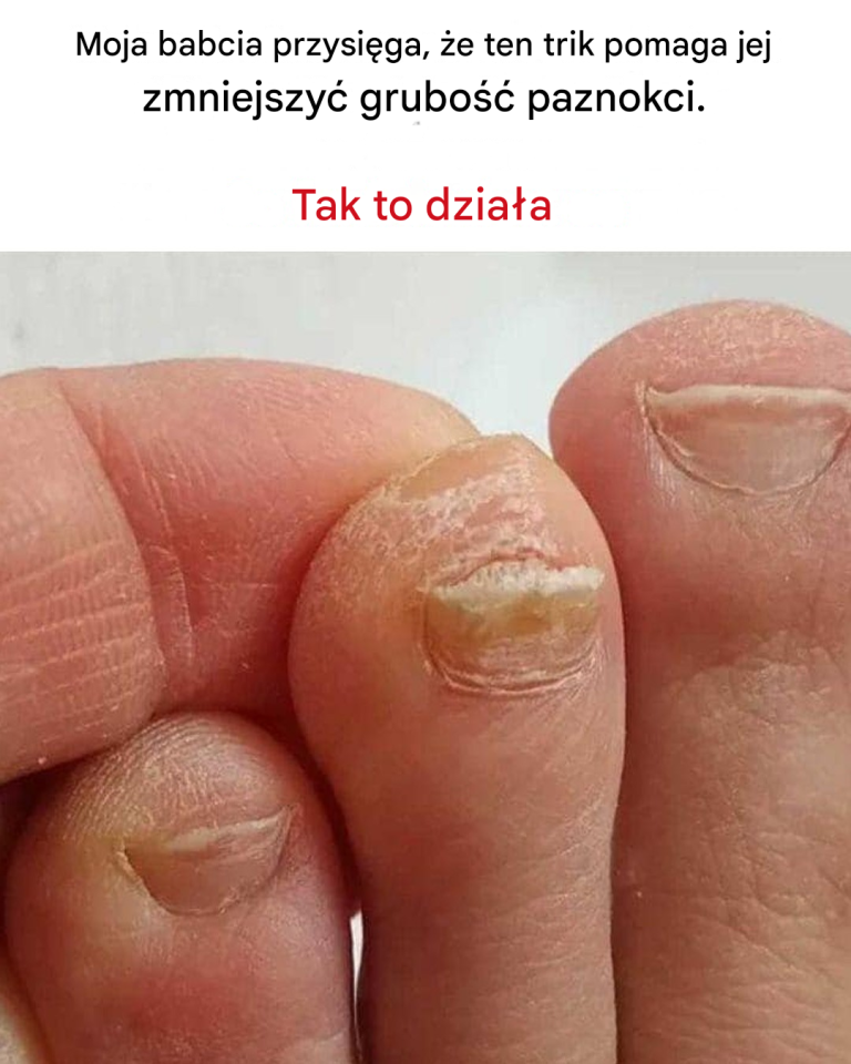 Sztuczka na zmniejszenie grubości paznokci u stóp