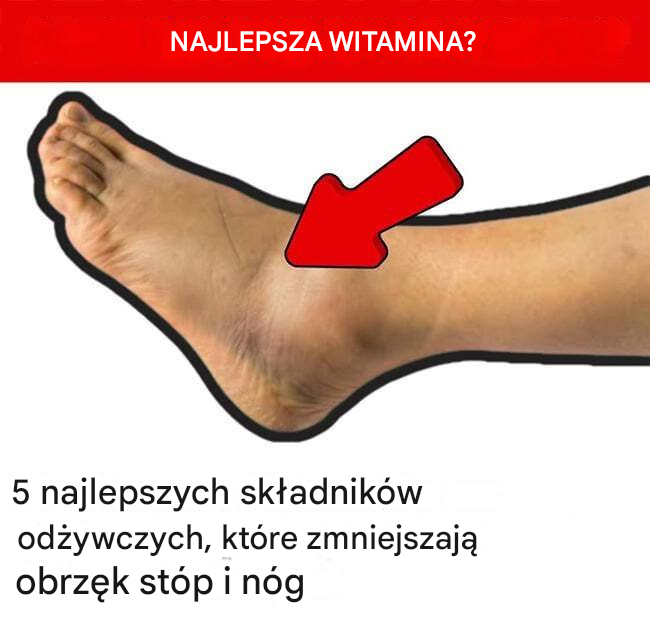 5 najlepszych składników odżywczych, które zmniejszają obrzęk stóp i nóg