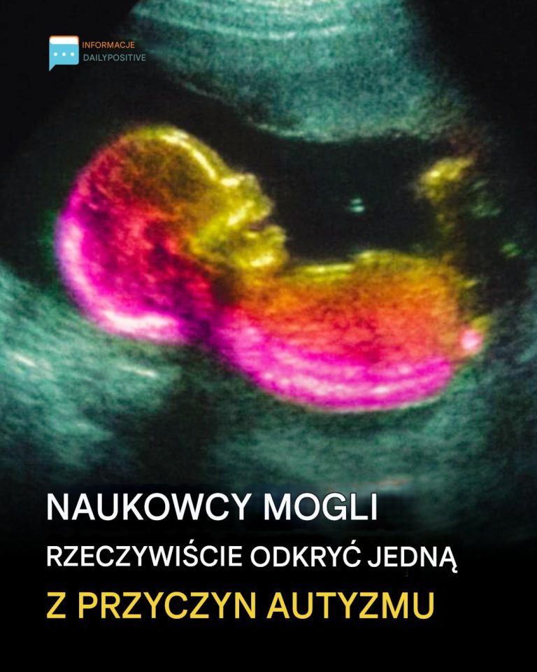 Badania sugerują kluczowe powiązanie, które może pomóc wyjaśnić rozwój autyzmu